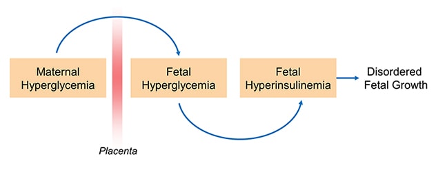 Hyperglycemia-hyperinsulinemia (Pedersen) hypothesis