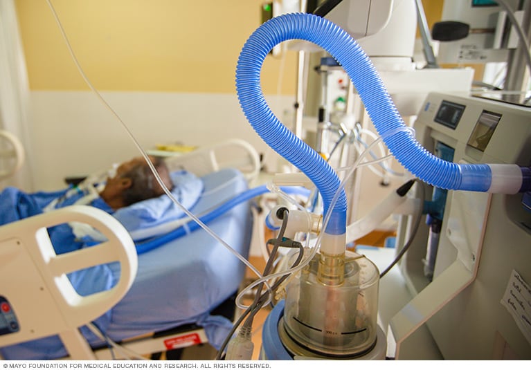 Mayo Clinic on the path to personalization of mechanical ventilation