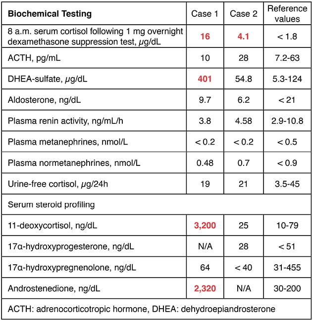 Biochemical workup of two patients with left adrenal mass