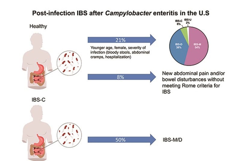 Post Infection Irritable Bowel Syndrome, Can Ibs Cause Large Stools
