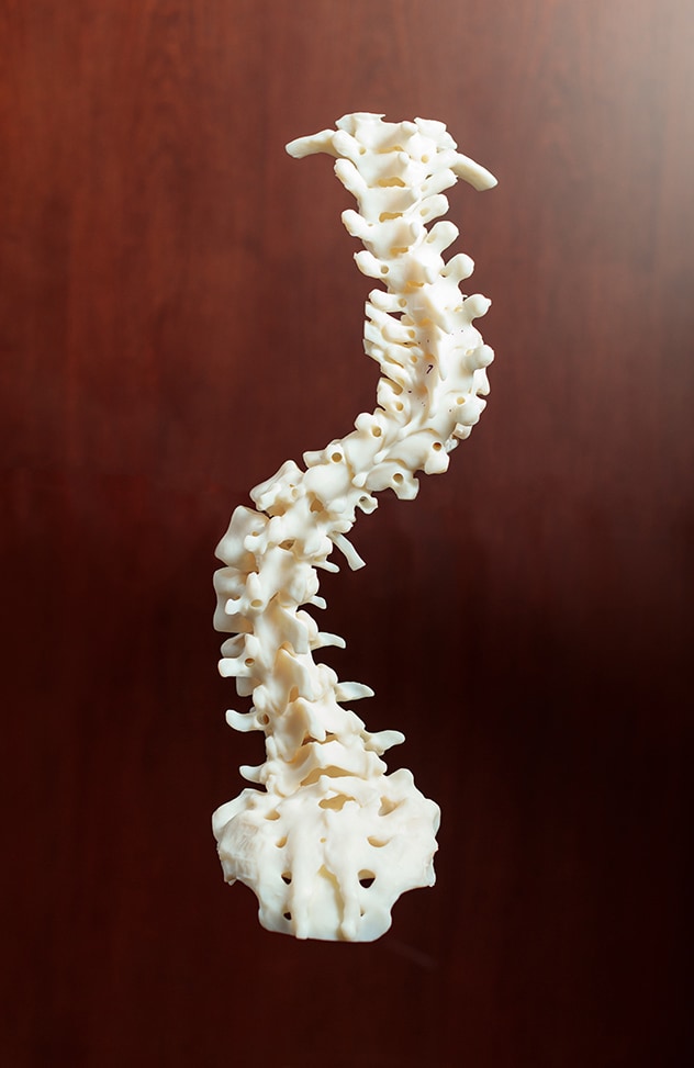 3D image of spine before resection