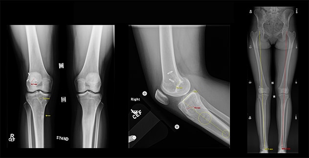 Pre-op imaging