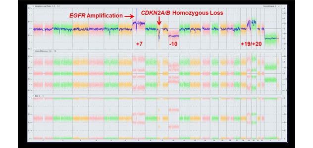 Critical tumor information