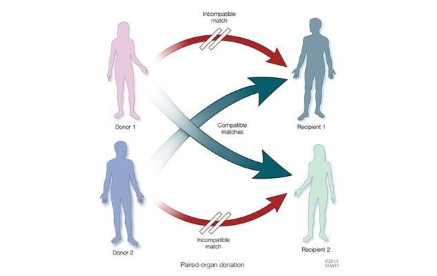 Paired organ donation