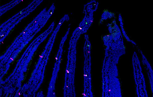 Gut touch sensors in mouse small bowel