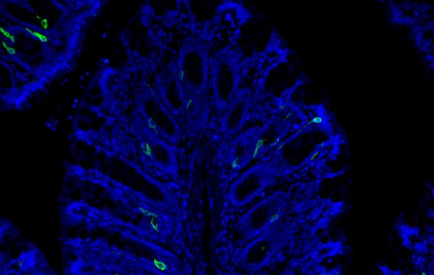 Optogenetic gut touch sensors