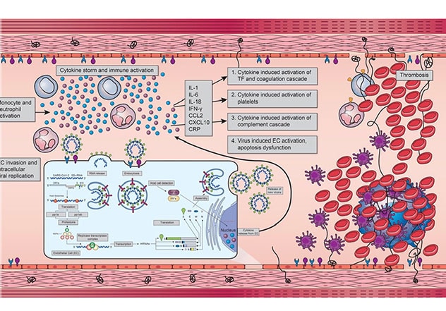 Schematic model of proposed pathogenesis
