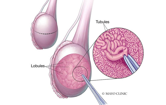 Seminiferous tubules within the testicle
