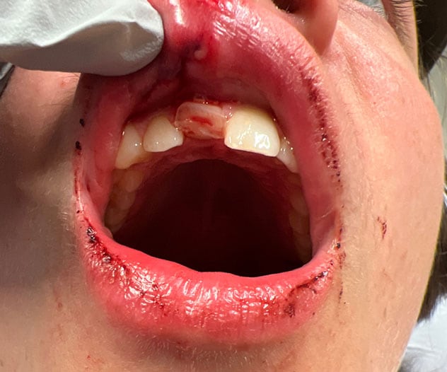 Dental trauma examination