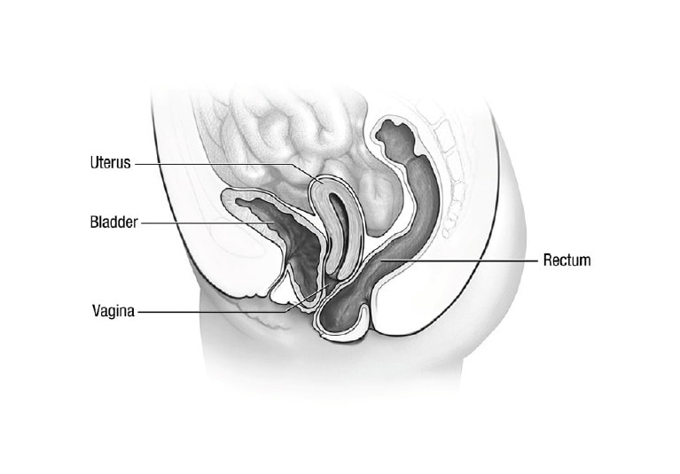 Table 4 from Vaginal support pessaries: indications for use and fitting  strategies. | Semantic Scholar