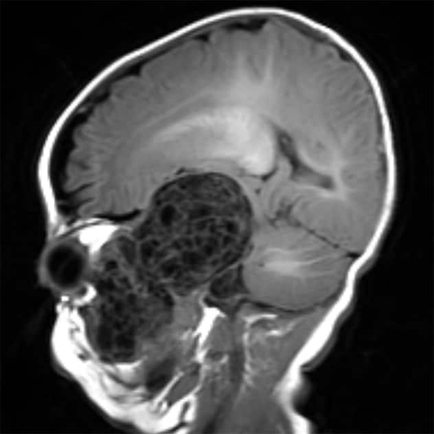 Brain Cancer Concept Anatomical Shape Of Brain Lies Near Word Cancer  Surrounded By Set Of Tests Analysis Drugs Mri Of Skull And Stethoscope  Diagnosis Treatment Of Brain Cancerous Tumors Stock Photo 