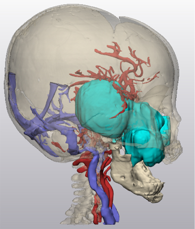 Reconstrucción 3D