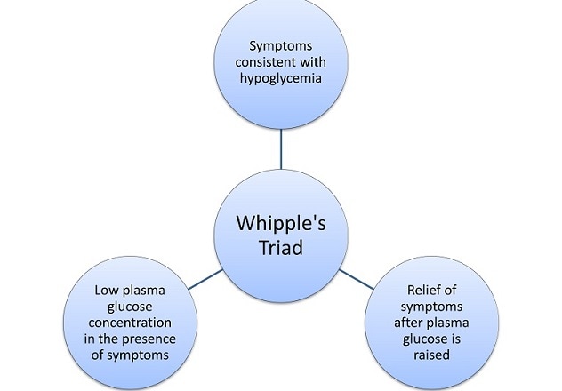 Whipple's Triad