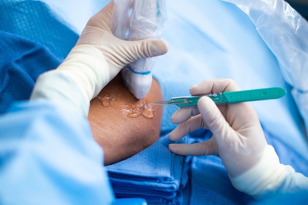 Percutaneous pressured hydrotenotomy