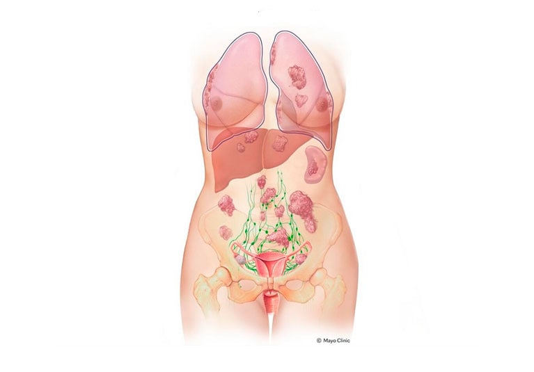 case study obstetrics gynecology