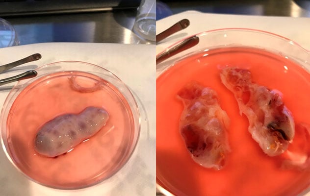 Adult ovarian tissue