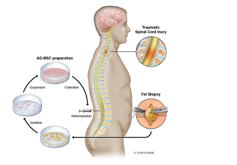 stem cell research case studies