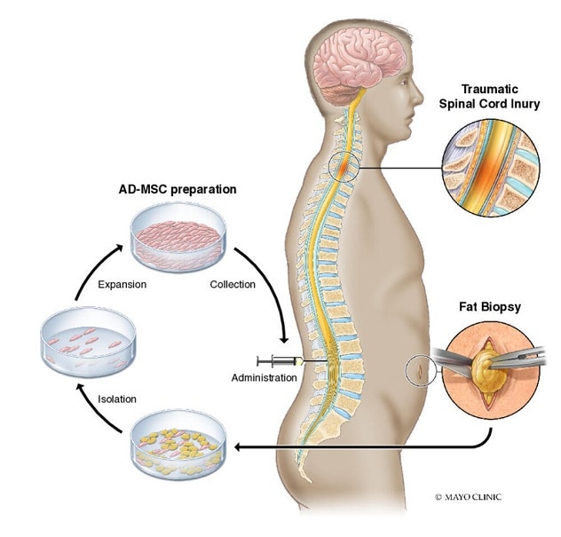 Proceso del tratamiento
