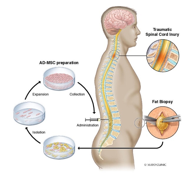 Treatment process