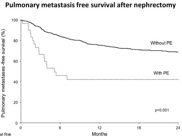 Pulmonary metastases