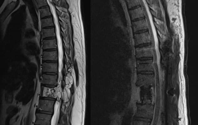 Challenging resection