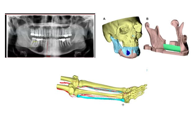 X-ray and virtual models