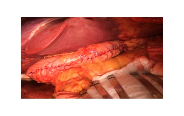 Simultaneous surgery