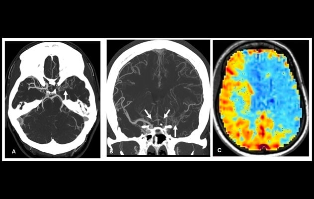 Imaging that guides treatment plans