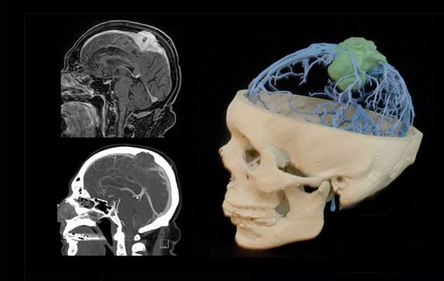 Personalized tumor imaging
