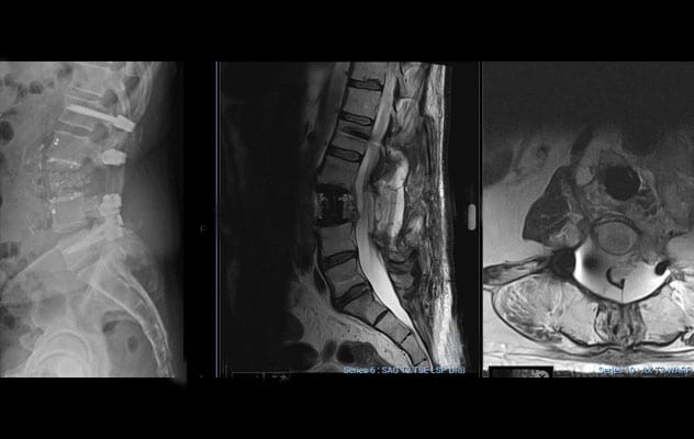Postoperative imaging