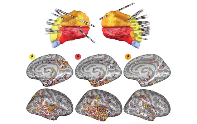 Stimulating pulvinar subregions
