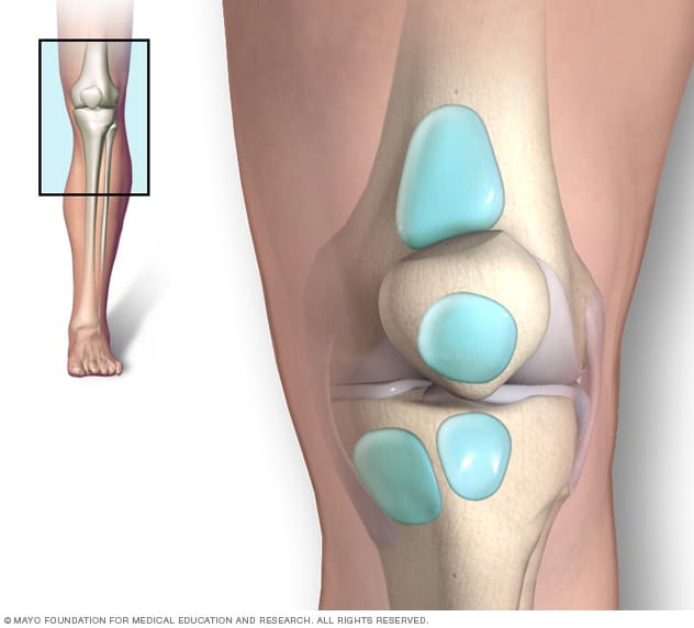 Bolsa sinovial de la rodilla