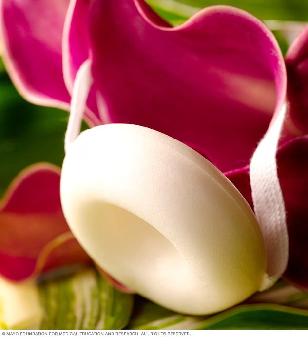 Contraceptive sponge Mayo Clinic