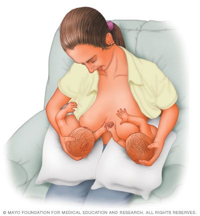 Double Clutch Or Double Football Hold Mayo Clinic