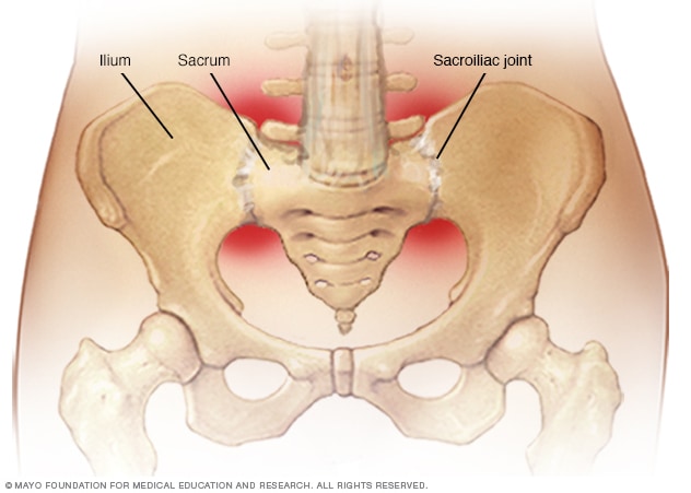 Sacroiliac joints - Mayo Clinic