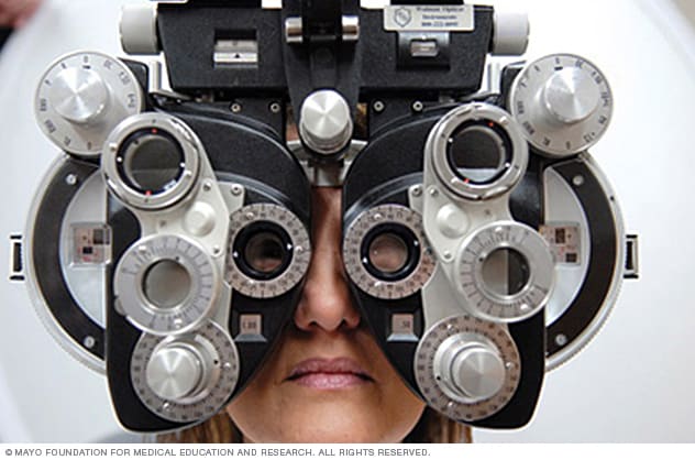 A woman undergoing refraction assessment