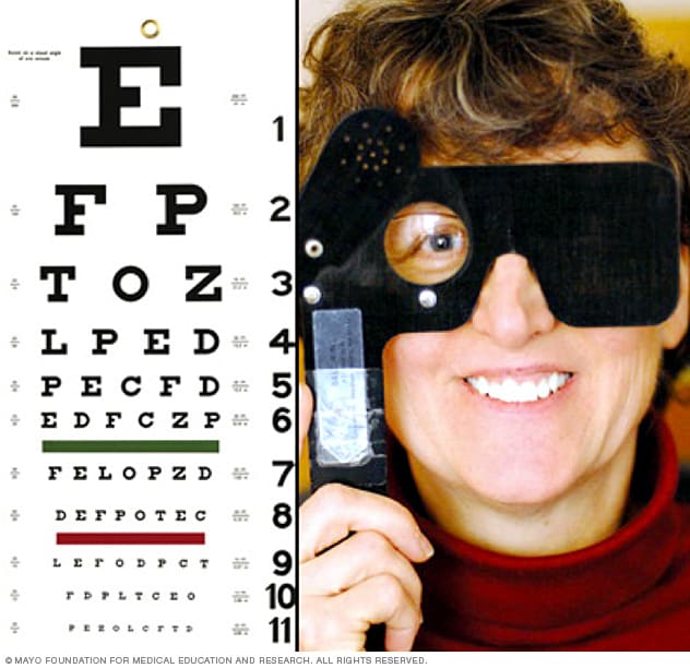 Examen Ocular Mayo Clinic