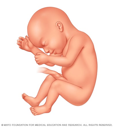 Fetus 23 weeks after conception