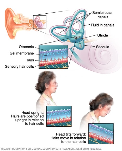 Dizziness Symptoms and causes Mayo Clinic Dizziness Symptoms and causes Mayo Clinic