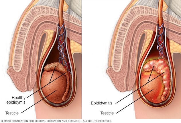 阴囊、睾丸和附睾的图示