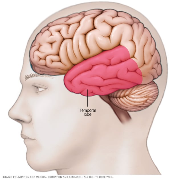 location-of-temporal-lobe-mayo-clinic