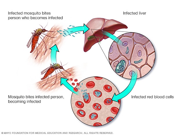 Malaria transmission cycle - Mayo Clinic