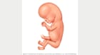 جنين بعمر 10 أسابيع بعد حدوث الحمل 