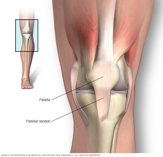 显示髌骨和髌腱的膝关节图示