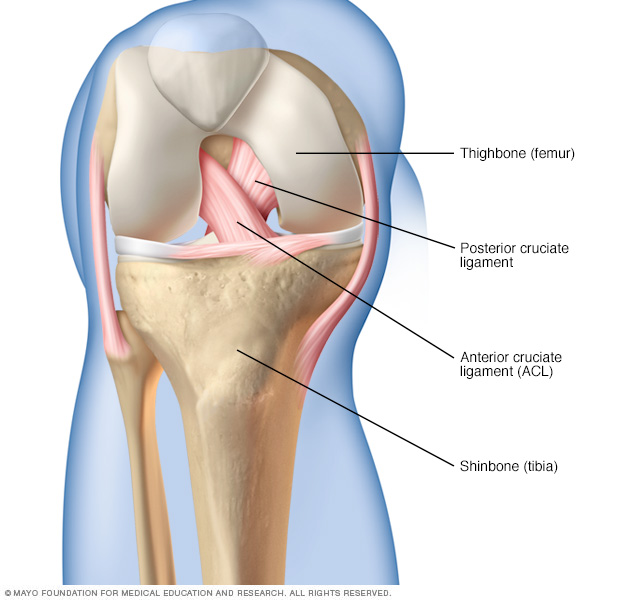 acl definition