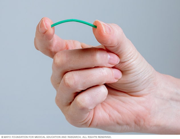 Contraceptive implant device