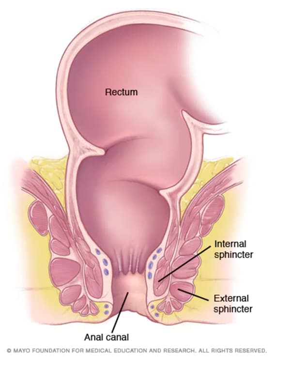 سرطان الشرج الأعراض والأسباب Mayo Clinic مايو كلينك
