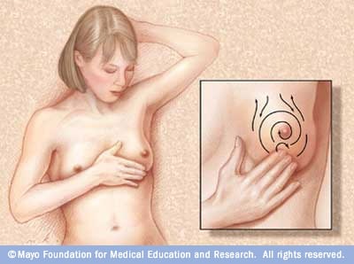 乳房自检图示 