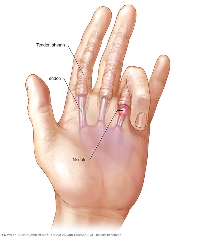 Day 48: crooked fingers, or take pictures of your hands – It's Dai Time