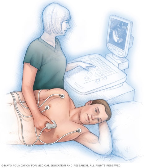 Helt tør tæt vride Echocardiogram - Mayo Clinic